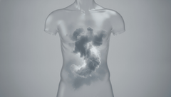 How Stress Impacts Gut Health and Why It Matters